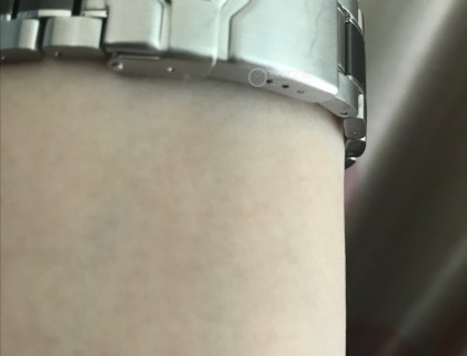 表扣处划痕非常明显，甚至还有小坑。