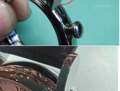 另一边表耳补钢修复效果