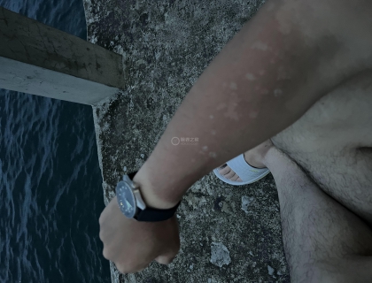 海边玩一定要穿长袖，都晒爆皮了，五十噚的位置，明显一道痕迹